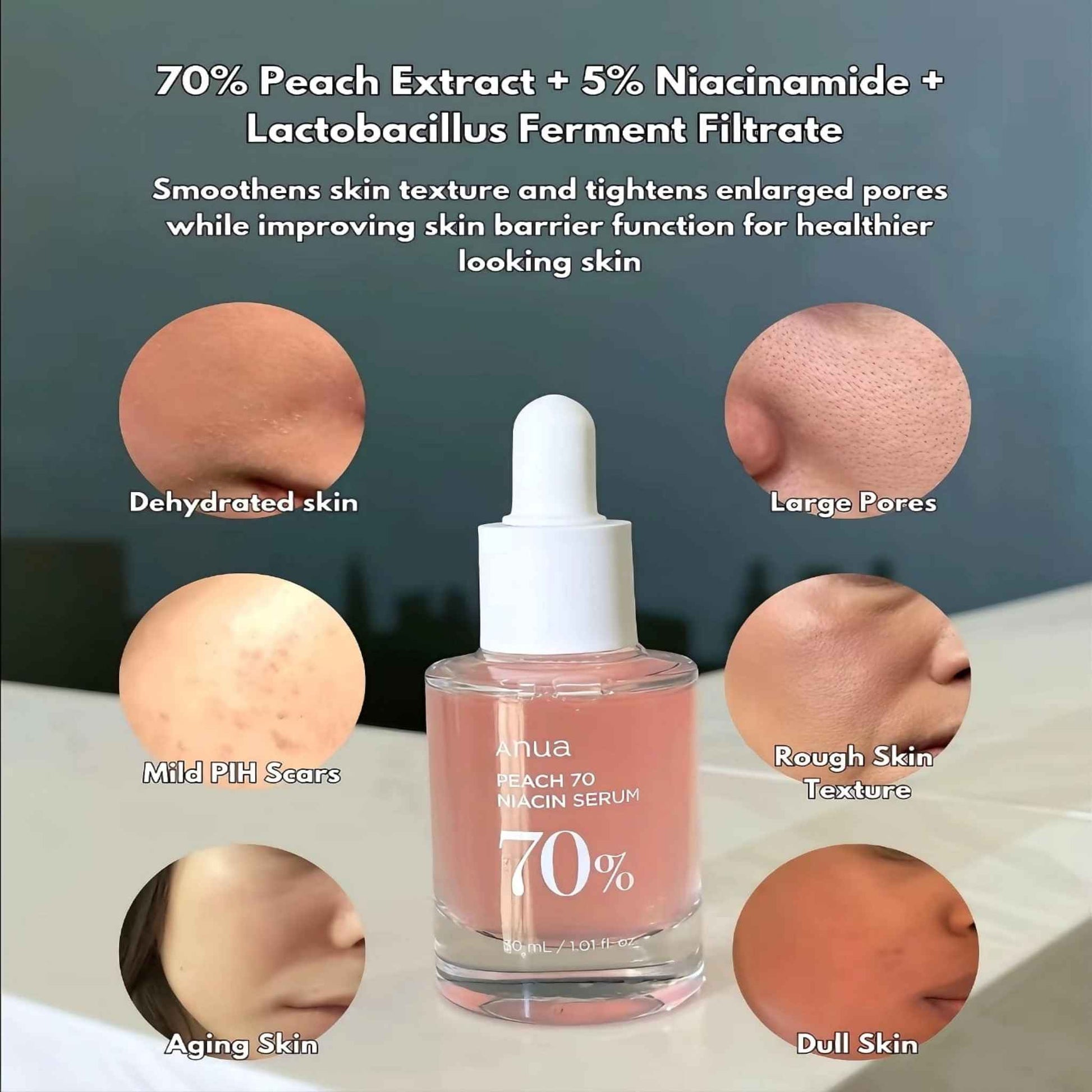 Anua,Peach 70% Niacin Serum 30ml price in Qatar