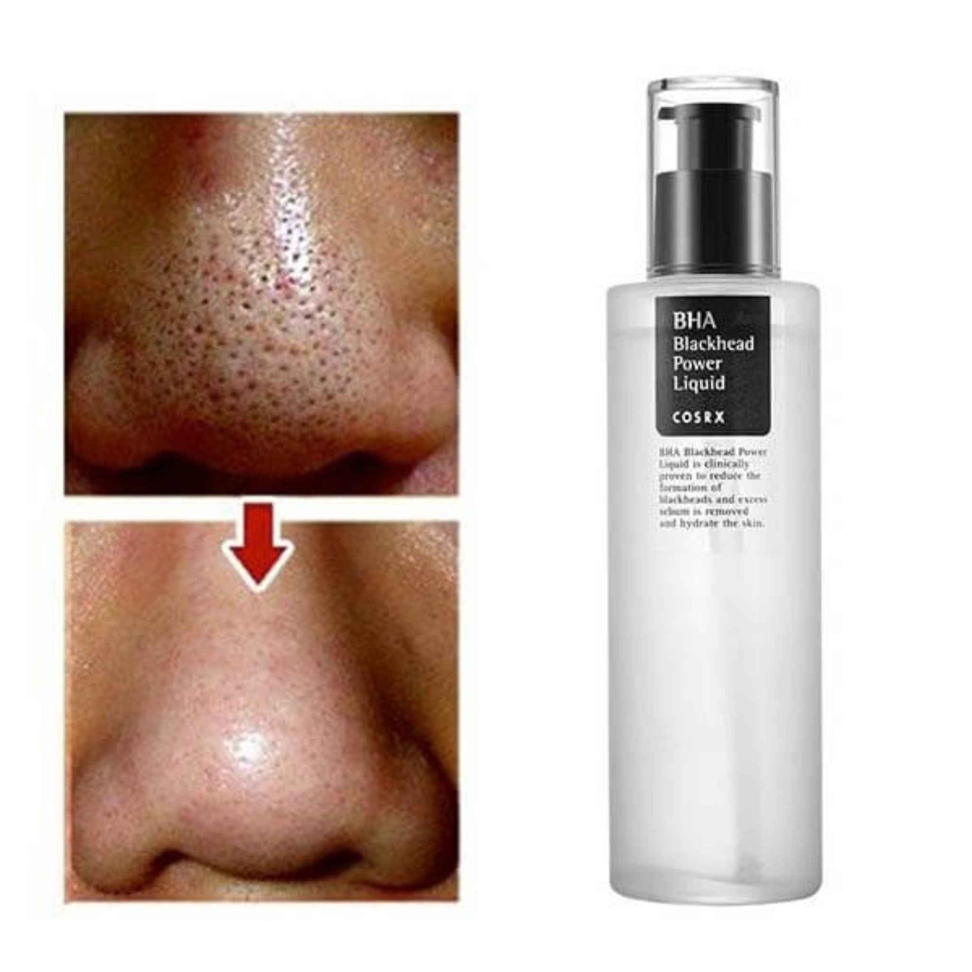 COSRX, BHA Blackhead Power Liquid 100ml price in Qatar