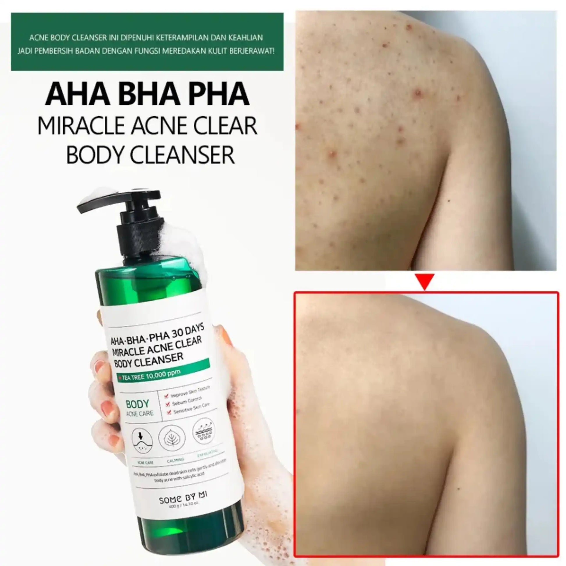 Shop SOME BY MI, AHA BHA PHA 30 Days Miracle Clear Body Cleanser 400g Online in Qatar