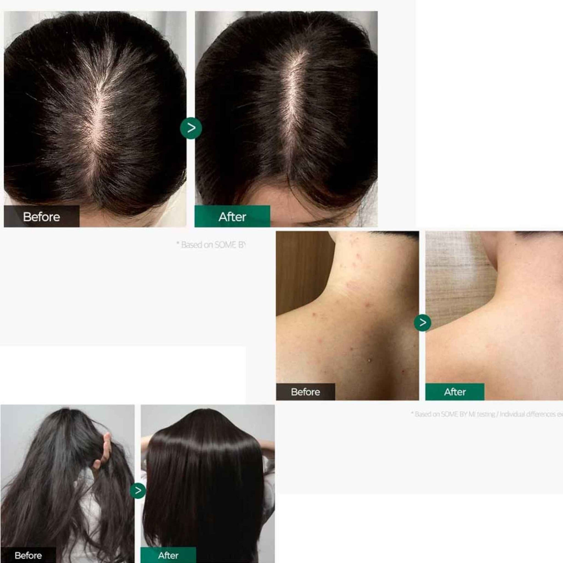 Shop SOME BY MI, Miracle Hair & Body Starter Kit Online in Qatar
