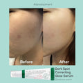 image of AXIS-Y, Dark Spot Correcting Glow Serum 50ml All About Skin Doha Skincare Qatar Beauty Cosmetics Available in Qatar Available in Qatar Store