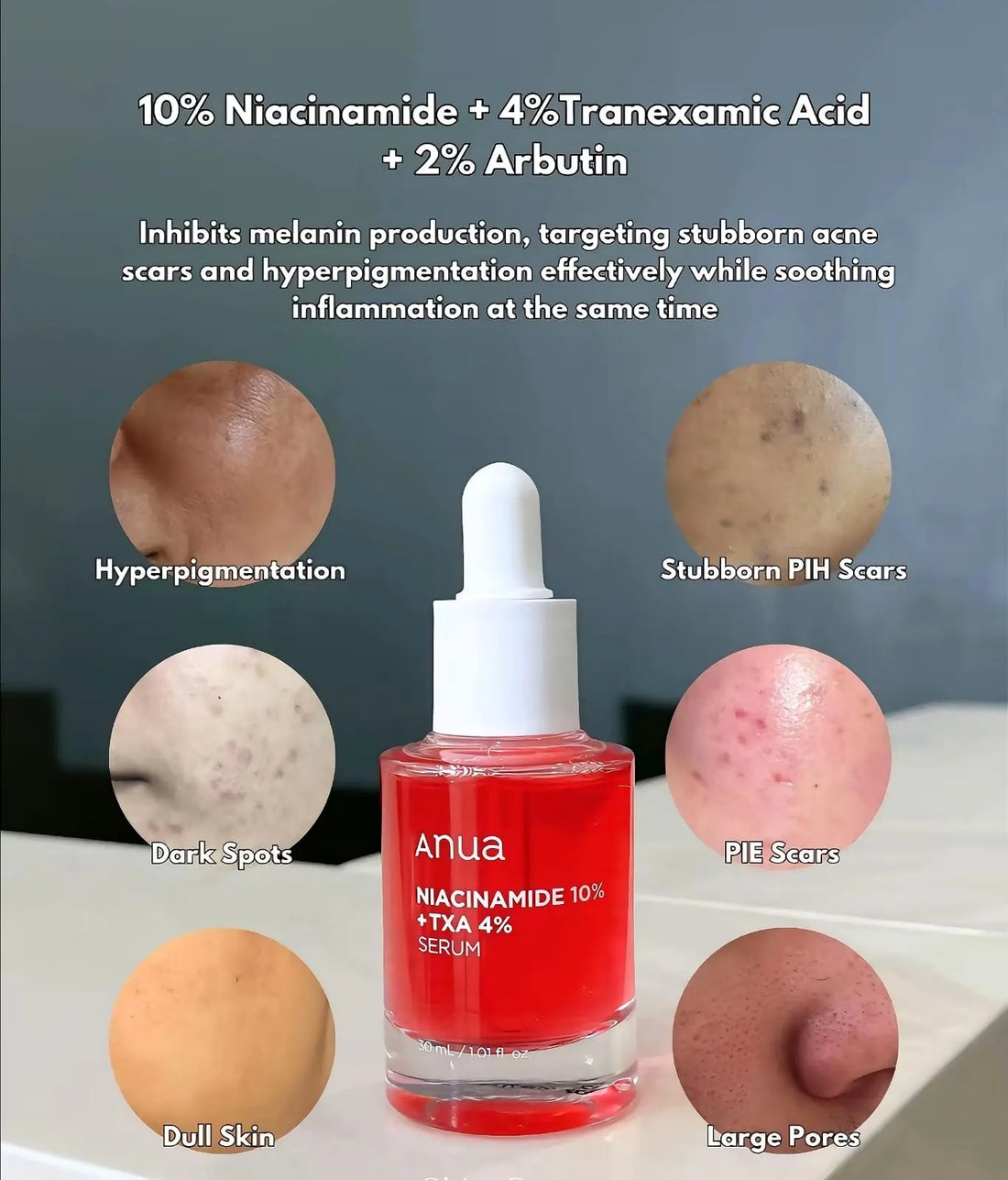 Anua, Niacinamide 10% + TXA 4% Dark Spot Correcting Serum 30ml