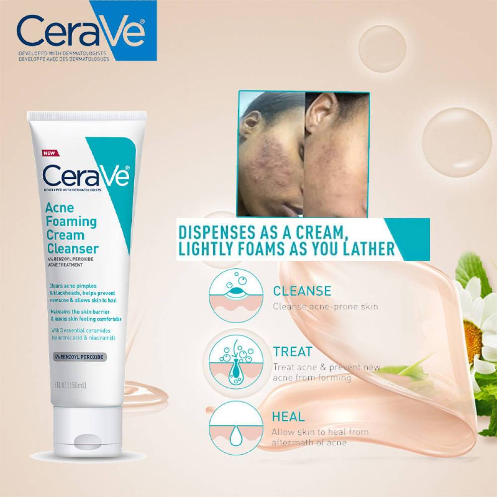 CeraVe Acne Foaming Cleanser 4 Benzoyl Peroxide Acne Treatment Qatar
