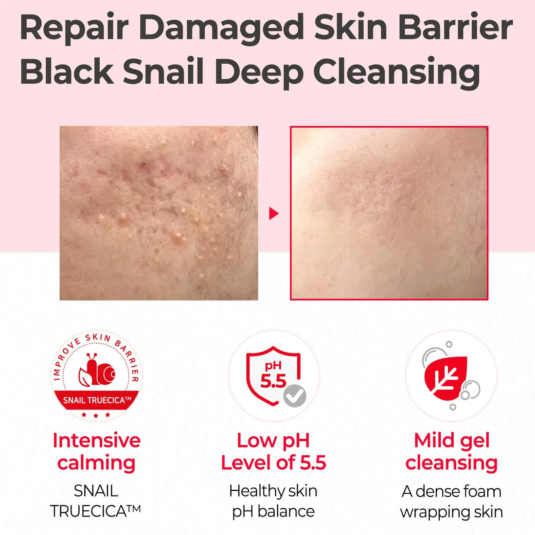 Buy SOME BY MI, Snail Truecica Miracle Repair Low ph Gel Cleanser 100ml Online in Qatar