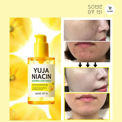SOME BY MI, Yuja Niacin 30days Blemish Care Serum 50ml Price in Qatar