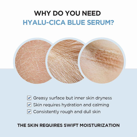 SKIN1004, Madagascar Centella Hyalu-Cica Blue Serum Price in Qatar