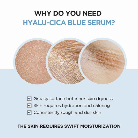 SKIN1004, Madagascar Centella Hyalu-Cica Blue Serum Price in Qatar